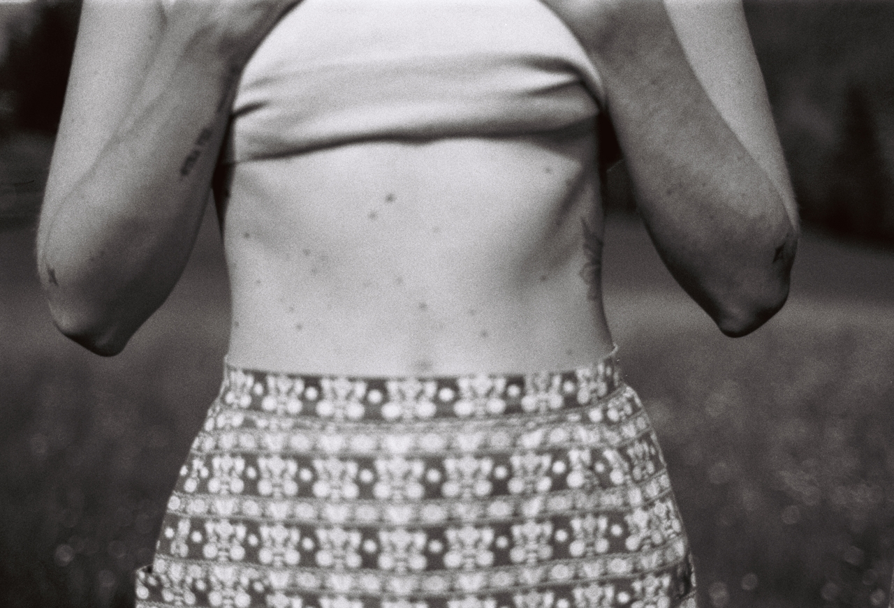 Total Body Clearance: The Clinical Case for Stacking Glutathione with Lipo-MIC for Metabolic Detox