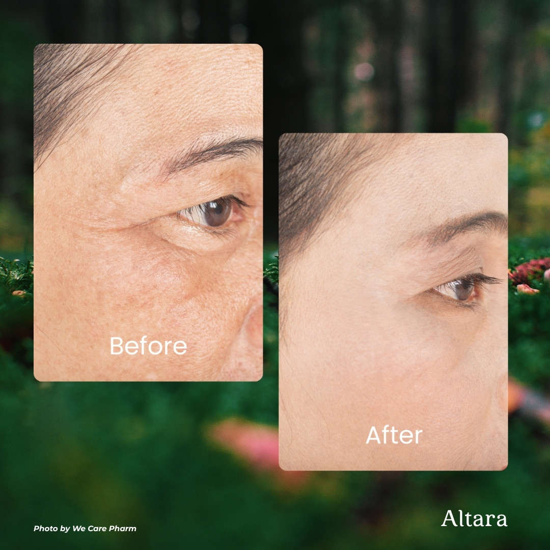 GHK-Cu injectable skin rejuvenation therapy packaging